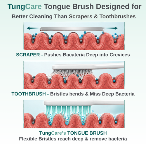TungCare Tongue Cleaning Gel + Brush Combo