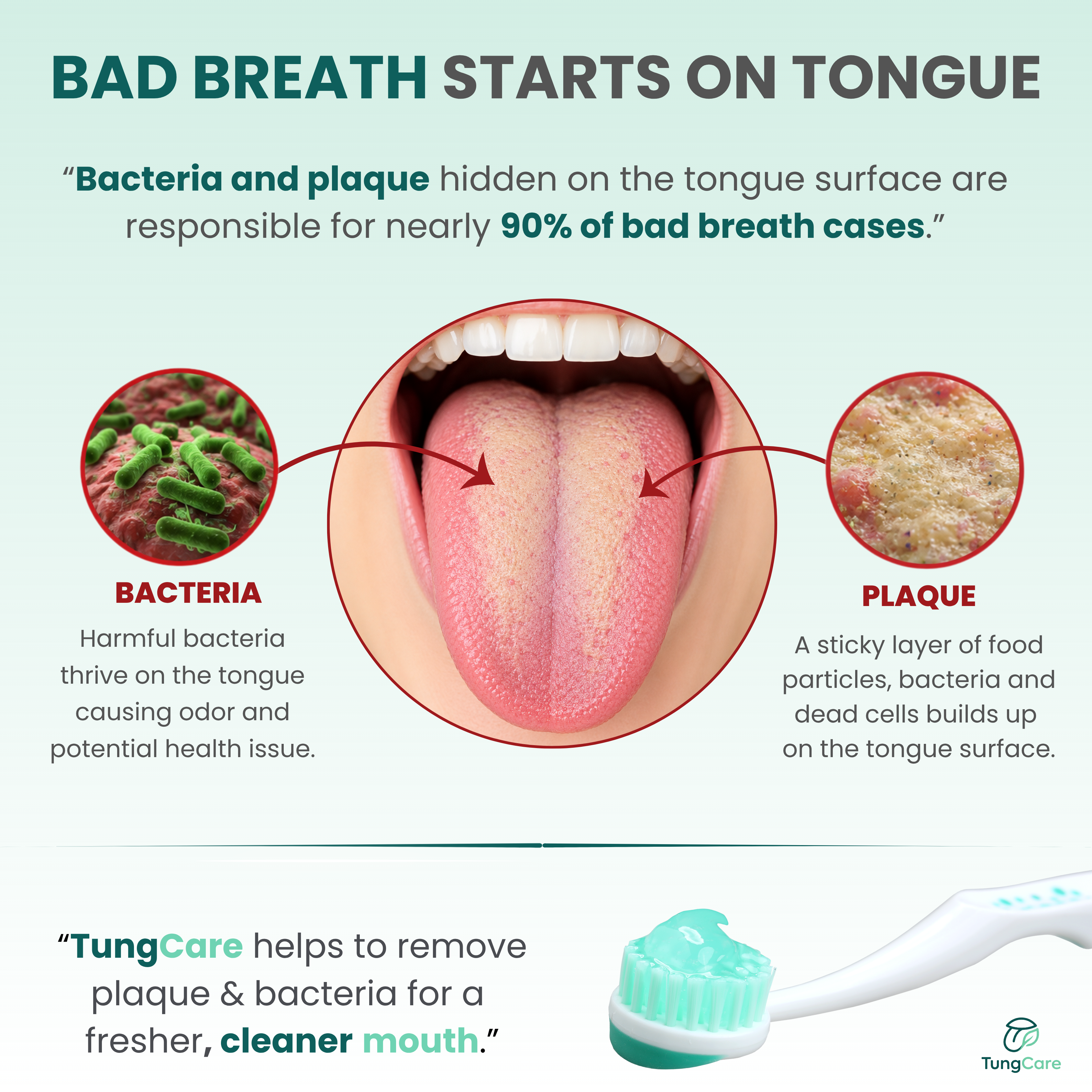 Why tongue care matters